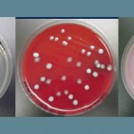 bacteria colonies